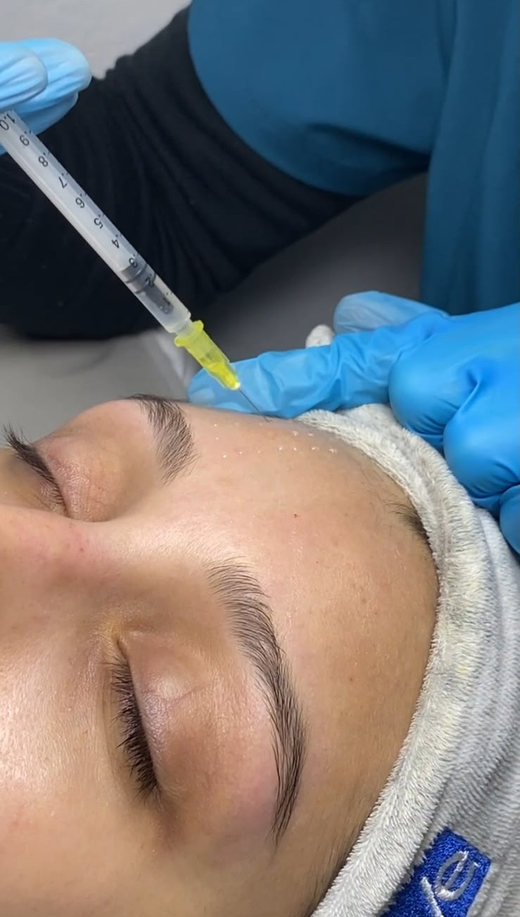 Limpieza Facial Revitalizante con Mesoterapia
